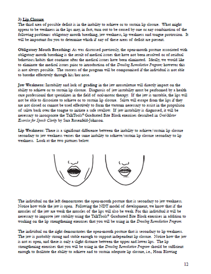 Drooling Remediation Manual E-Book (without kit) -  Talk-Tools