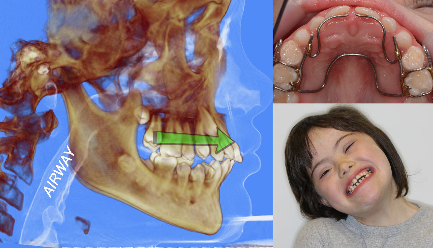 *NEW E-LEARNING* Airway, Apnea, Orthodontics, and OPT - selfstudy Talk-Tools