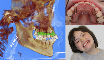 *NEW E-LEARNING* Airway, Apnea, Orthodontics, and OPT - selfstudy Talk-Tools